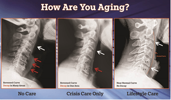 A Picture is Worth 1000 Words