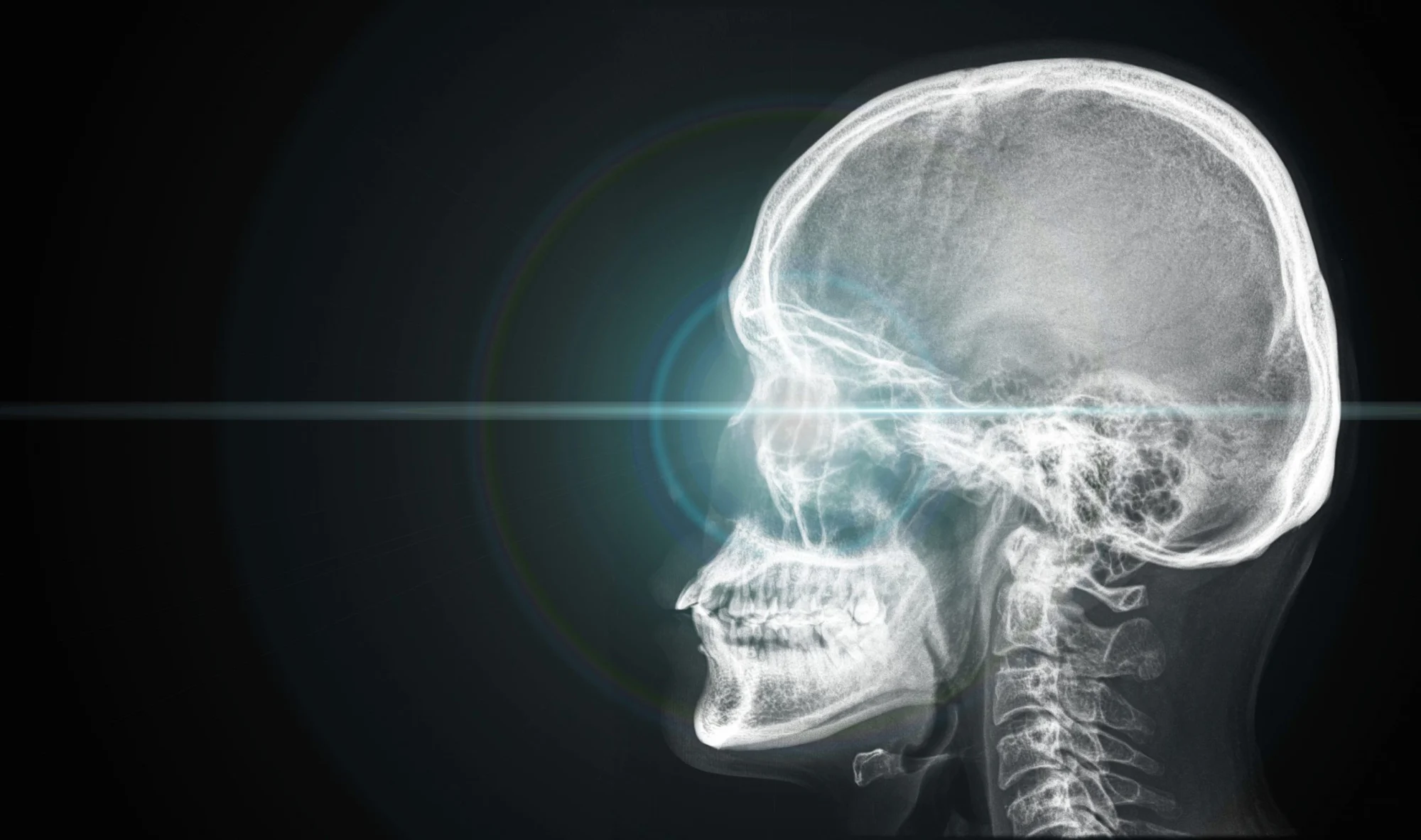 The Hidden Effects of Head Injuries
