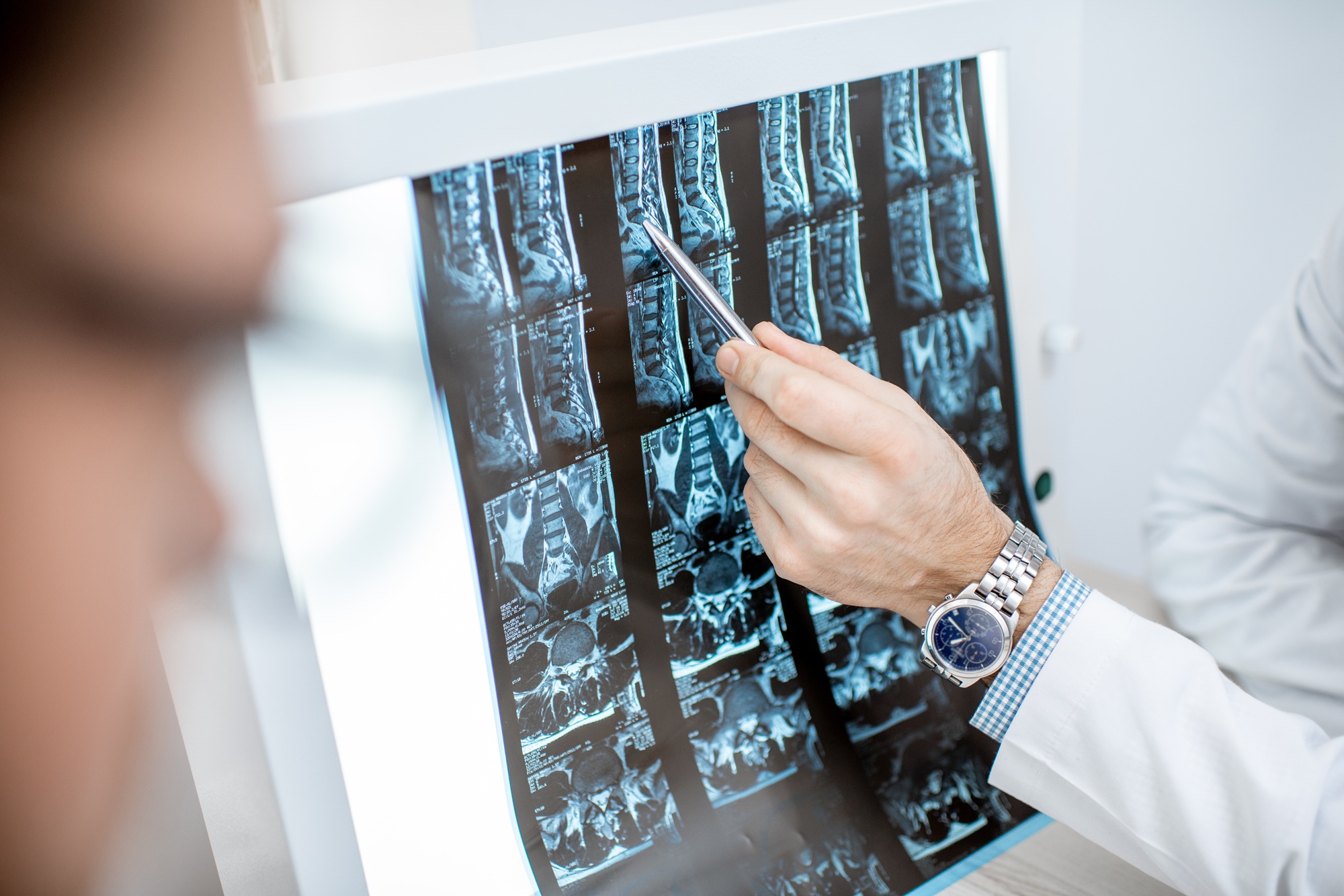 MRI Results Aren’t Your Destiny